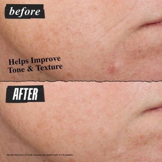 Micro-Dose Anti-Aging Retinol Serum with Ceramides and Peptide