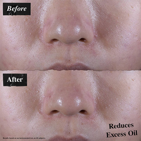 Dry-Skin Defense Kit (Oil-Free)