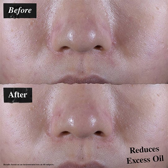 Ultra Facial Oil-Free Gel Cream Set