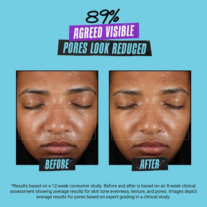 Super Multi Corrective Soft Cream