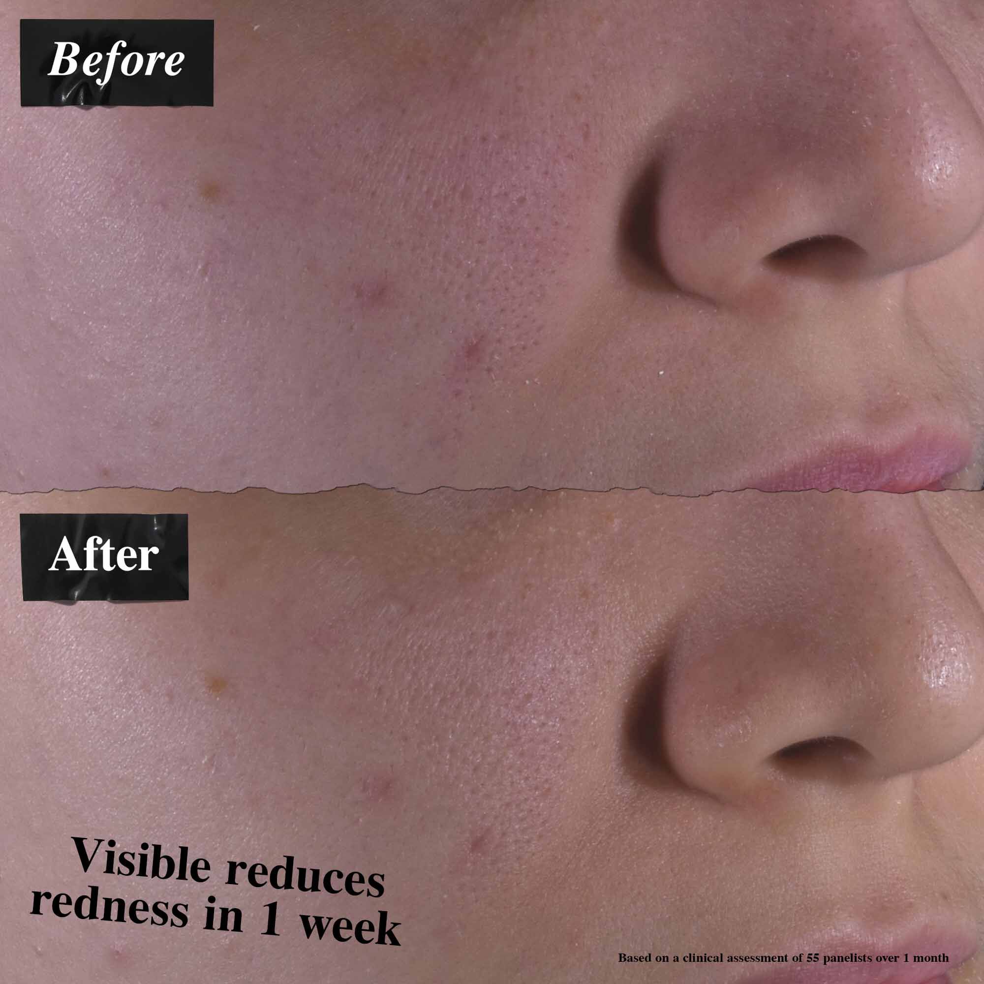 Calendula Herbal-Extract Alcohol Free Toner