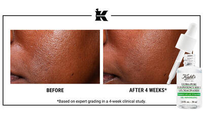 Before and After Retinol Serum