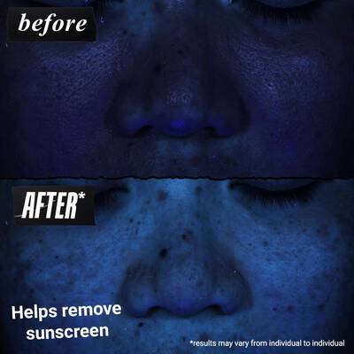 Kiehl's Ultra Facial Barrier- Hydrating Cleanser before and after results ​